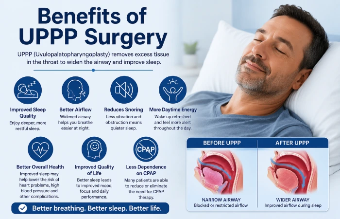 benefits of uppp surgery